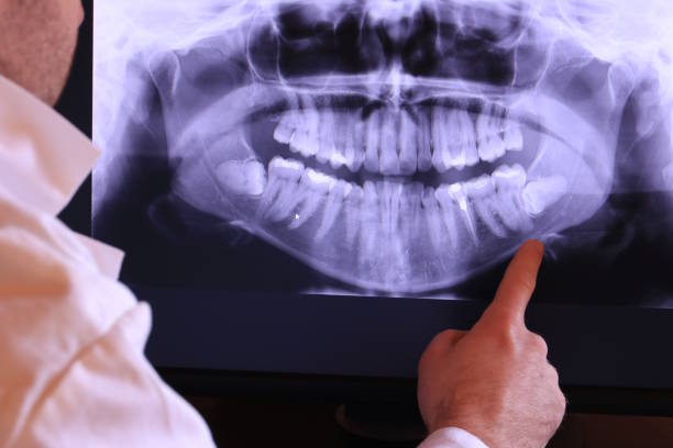 Best Chipped Tooth Repair Near Me  in Newark, IL