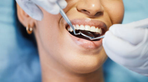 Best Teeth Whitening  in Newark, IL