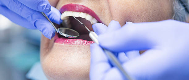 Best Dentist for Tooth Abscess  in Newark, IL